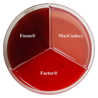 Minnesota Vet Diagnostic Lab Tri Plate : Each